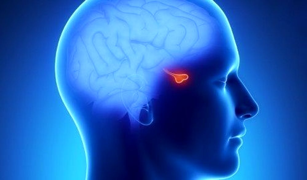 Sindrome di Cushing, primi sintomi e farmaci per la cura