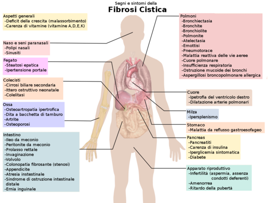 La Fibrosi Cistica cosa è? Causa, sintomi e cura