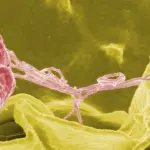 La Salmonellosi, sintomi e cura