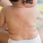 Salute dei bambini, malattie esantematiche e sicurezza in auto