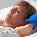 Come effettuare la medicazione di piaghe da decubito sacrali