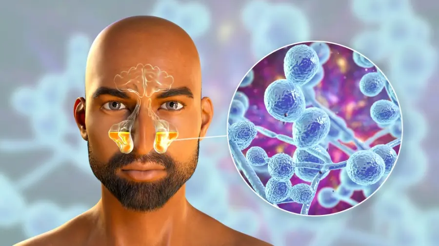 Tutto quello che c’è da sapere sulla candida nell’uomo