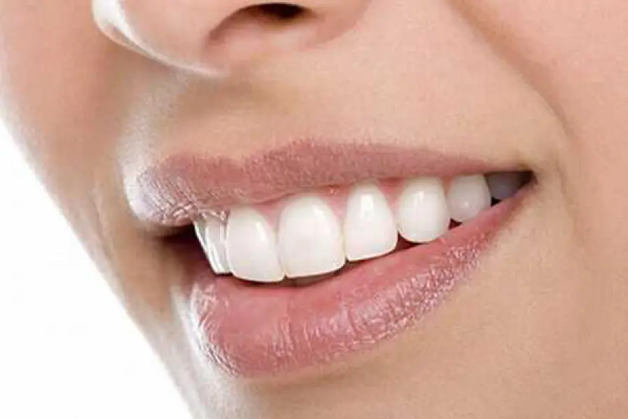 La cura dei denti: consigli pratici